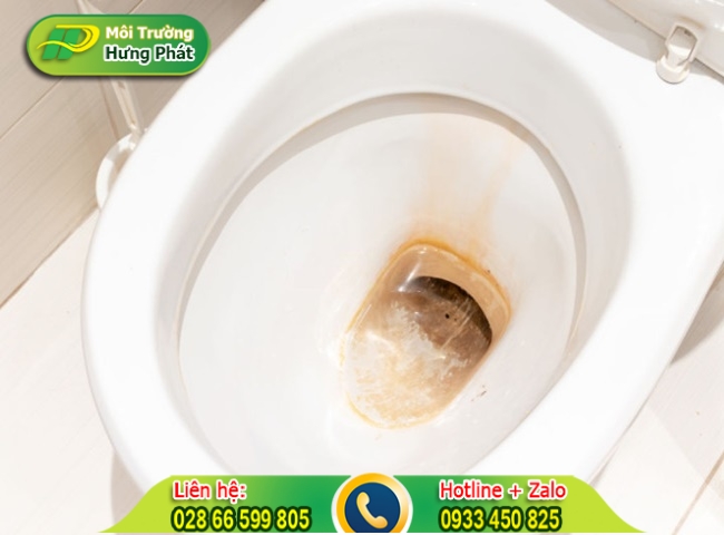 Bồn cầu nh&agrave; vệ sinh ố v&agrave;ng